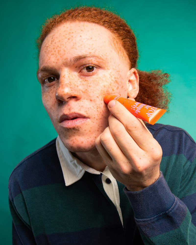 Anti-blemish roller